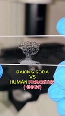 Baking Soda VS Human Parasites  (+Eggs) 🤔