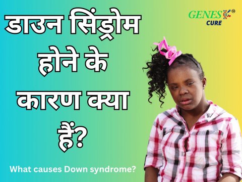 What Causes Down Syndrome?