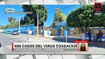 En Puebla, la SEP confirma más de 400 contagios de Coxsackie en escuelas