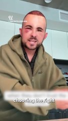 By day 3 he's completely unrecognisable 😱