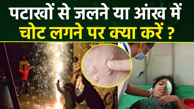 Diwali 2025: दिवाली के पटाखों से जलने पर क्या करें | Diwali Ke Patakhe Se Jalne Par Kya Kare