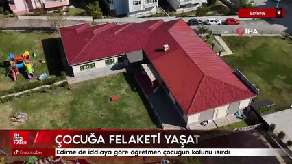 Edirne’de iddiaya göre öğretmen çocuğun kolunu ısırdı