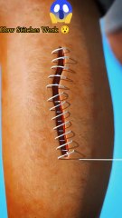 How Stitches Work 😯 #magic #thrille #thrillont