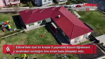 Edirne'de akılalmaz olay! Öğretmen, 3 yaşındaki çocuğu ısırdı: Öperken oldu