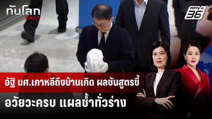 ผลชันสูตร นศ.เหยื่อ "สแกมโบเดีย" พบรอยช้ำ แต่อวัยวะอยู่ครบ | ทันโลก DAILY | 21 ต.ค. 68