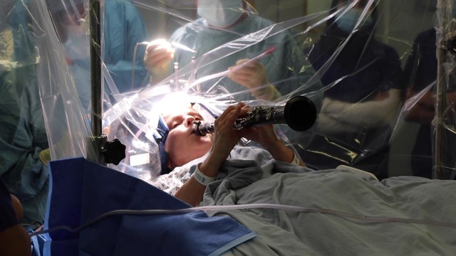 La donna operata al cervello a Londra mentre suona il clarinetto