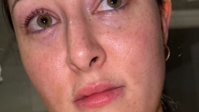 Spider crawls onto girl’s back and creeps up around her neck and face