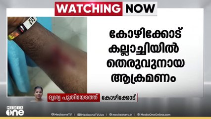 കോഴിക്കോട് കല്ലാച്ചിയിൽ തെരുവുനായ ആക്രമണം; പതിനഞ്ച് പേർക്ക് കടിയേറ്റു