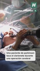 Una paciente de parkinson toca el clarinete durante una operación cerebral