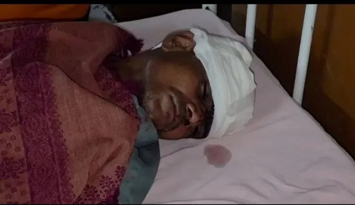 रास्ते के विवाद पर दो पक्षों में चले लाठी-डंडे; तीन घायल, 1 जिला अस्पताल रेफर