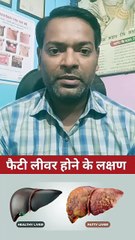 फैटी लीवर के लक्षण ।
