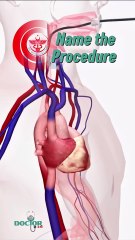 Name the procedure...