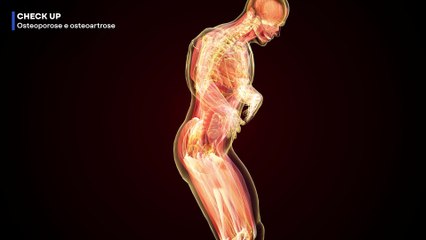 Qual a diferença entre osteoporose e osteoartrose? Dr. Dan Oizerovici comenta | CHECK UP