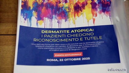 Dermatite atopica, i pazienti chiedono riconoscimento e tutele
