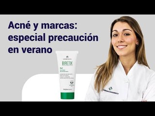 ACNÉ Y MARCAS ESPECIAL PRECAUCION EN VERANO
