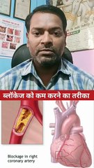 ब्लॉकेज को कम करने का तरीका ।