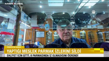 Ehliyet için gitti, 8 parmağında iz olmadığını öğrendi