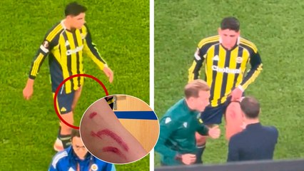 Edson Álvarez termina con tremendas lesiones tras campal en el Fenerbahce vs Stuttgart