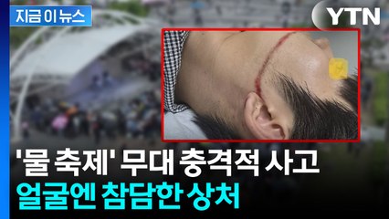 '물 축제' 워터건 참사...피해 대학생 "누구도 책임지려하지 않는다" 호소 [지금이뉴스]  / YTN