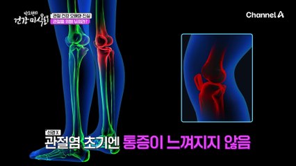 관절 건강에 대한 오해와 진실들