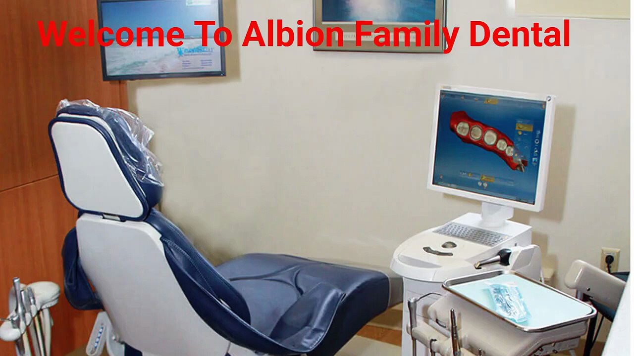 Albion Family Dental - Permanent Solutions With Tooth Implants in Albion, NY