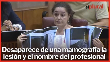 Desaparece de una mamografía el nombre del profesional tras la "caída informática" en Andalucía