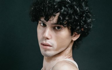 Vitiligine: serve più ricerca e sensibilizzazione. L'appello dell'esperto