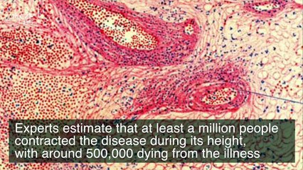 Why Did This Pandemic Left 1 Million Victims Frozen Like Statues?