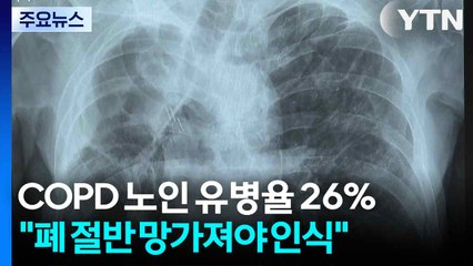 만성폐쇄성폐질환 노인 유병율 26%..."폐 절반 망가져야 인식" / YTN