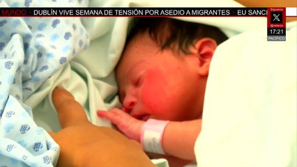 La estadística nacional de Espina Bífida aumentó un 2.35% con 90 casos en 2025