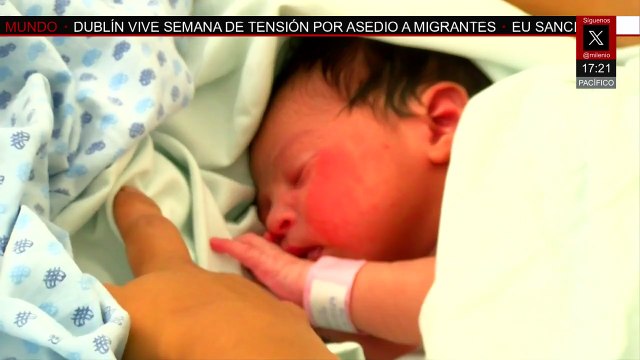 La estadística nacional de Espina Bífida aumentó un 2.35% con 90 casos en 2025