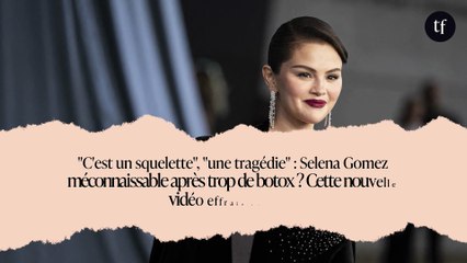 "C'est un squelette", "une tragédie" : Selena Gomez méconnaissable après trop de botox ? Cette nouvelle vidéo effraie ses fans