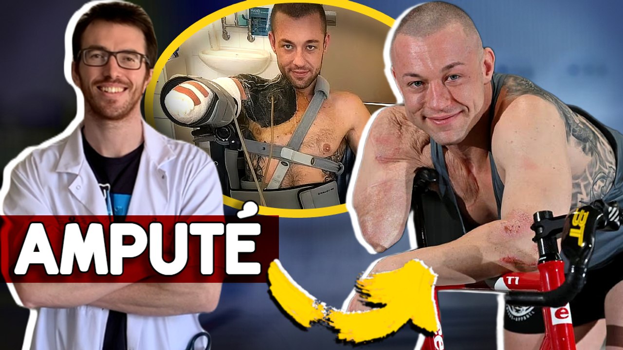 IL PERD LA MOITIE DE SON CORPS APRÈS UN ACCIDENT DE MUSCULATION