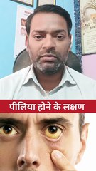 पीलिया होने के लक्षण ।