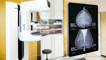 Early detection and healthy habits key in fight against breast cancer