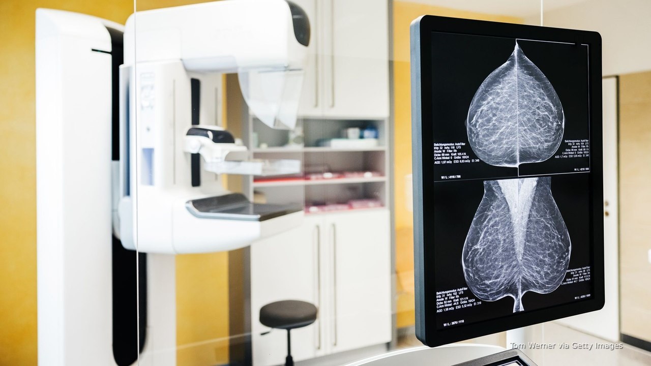 Early detection and healthy habits key in fight against breast cancer