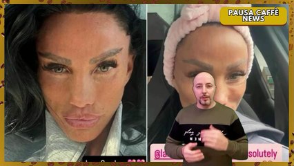 Katie Price irriconoscibile il botox le lascia il volto gonfio e irregolare