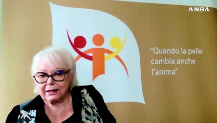 Corazza: "Serve piu' ascolto per chi convive con la vitiligine"