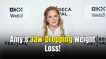 Amy Schumer Flaunts Toned Legs After Losing 30 Pounds