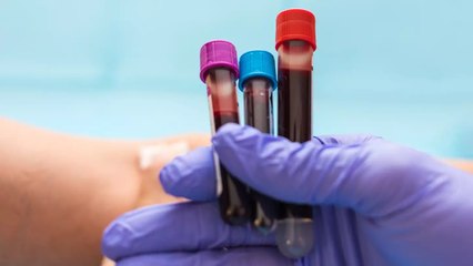 Decades-Long Mystery Solved: Scientists Discover New MAL Blood Group