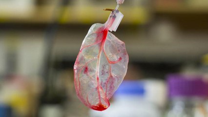 Researchers Grow Beating Human Heart Tissue Using Spinach Leaves