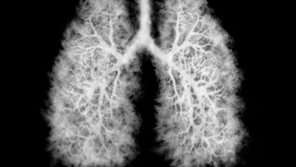 Caution Over Vaping After Teen Develops ‘Popcorn Lung’ Linked to Chemical Exposure