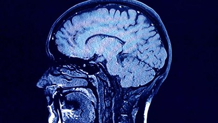 Study Finds You May Be Conscious Long Enough After Death to Realize It