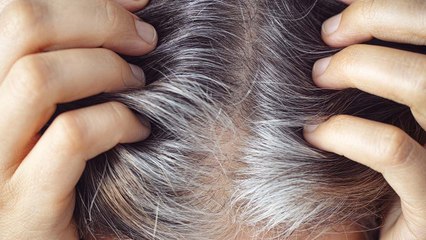 The Surprising Health Risk Linked to Gray Hair, According to Doctors