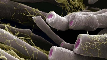 How an Imbalance in Bacteria Might Influence Multiple Sclerosis and Predict Its Severity