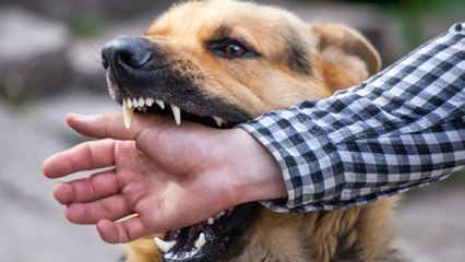 Rabies Kaise Hota Hai: क्या सिर्फ कुत्ते के काटने से रेबीज होता है क्या, Animal Bite Precaution...