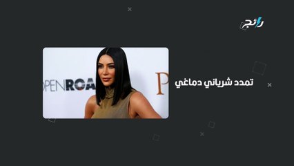 كيم كاردشيات تعلن إصابتها بمرض خطير!