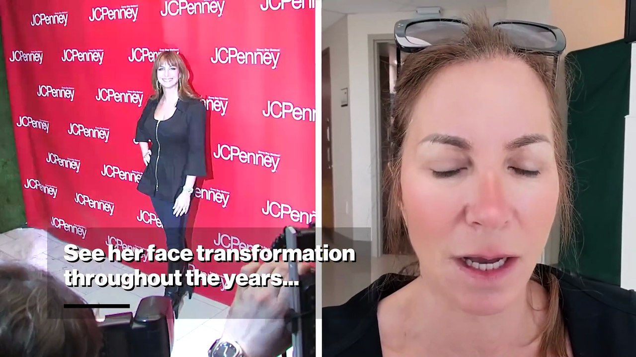 See 'RHONY' alum Jill Zarin's face transformation after being called out for having 'an entirely different face' on social media