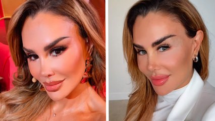 Ninel Conde presume en Instagram su cirugía de cambio de color de ojos; así cambia el "Bombón Asesino"