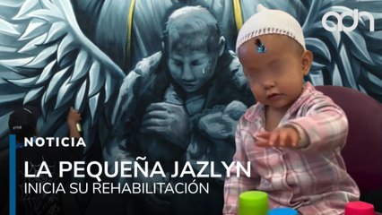 La pequeña Jazlyn inicia proceso de rehabilitación tras la explosión de una pipa en Iztapalapa